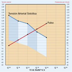 Imagen de registro de pulso y tensin arterial
